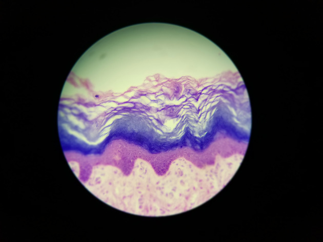 Stratified Squamous Epithelium Slides - Stratified Squamous Epithelium 11 400X